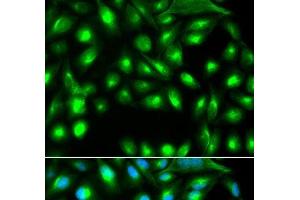 Immunofluorescence analysis of A549 cells using GEMIN2 Polyclonal Antibody (SIP1 抗体)