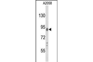 Western blot analysis of COG4 Antibody in A2058 cell line lysates (35ug/lane) (COG4 抗体  (C-Term))