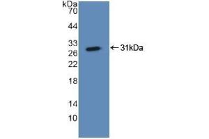 Detection of Recombinant ASGR1, Human using Polyclonal Antibody to Asialoglycoprotein Receptor 1 (ASGR1) (Asialoglycoprotein Receptor 1 抗体  (AA 77-289))