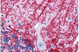 Human Brain, Cerebellum: Formalin-Fixed, Paraffin-Embedded (FFPE) (SIPA1L3 抗体  (N-Term))