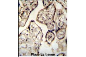 Immunohistochemistry (Paraffin-embedded Sections) (IHC (p)) image for anti-Synaptotagmin VIII (SYT8) (AA 67-96), (Middle Region) antibody (ABIN955026)