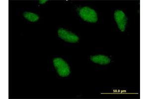 Immunofluorescence of purified MaxPab antibody to SAP18 on HeLa cell. (SAP18 抗体  (AA 1-153))