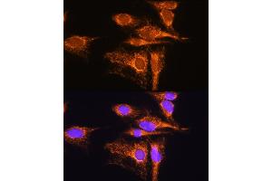 Immunofluorescence analysis of C6 cells using  Rabbit pAb (ABIN1678653, ABIN5664340, ABIN5664342 and ABIN6220284) at dilution of 1:100. (AMPD1 抗体  (AA 50-260))