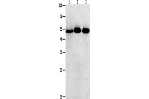 Western Blotting (WB) image for anti-Kruppel-Like Factor 5 (Intestinal) (KLF5) antibody (ABIN2431559)