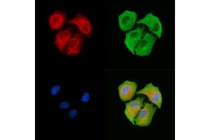 ABIN6263377 and ABIN6278723 staining  cells by IF/ICC. (MRPS11 抗体  (C-Term))