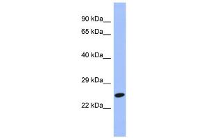 WB Suggested Anti-DRAP1 Antibody Titration: 0. (DRAP1 抗体  (N-Term))