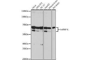 Western blot analysis of extracts of various cell lines, using hnRNP K antibody (ABIN7267634) at 1:2000 dilution. (HNRNPK 抗体)