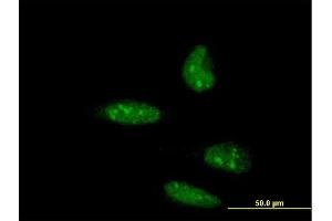 Immunofluorescence of monoclonal antibody to ATOH1 on HeLa cell. (ATOH1 抗体  (AA 266-354))