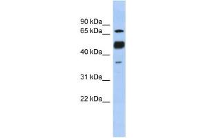 WB Suggested Anti-NFATC1 Antibody Titration:  0. (NFATC1 抗体  (N-Term))