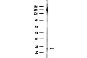 anti-Glutathione Peroxidase 8 (GPX8) (Internal Region) antibody