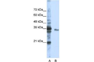 WB Suggested Anti-EXOSC3 Antibody Titration:  0. (EXOSC3 抗体  (Middle Region))