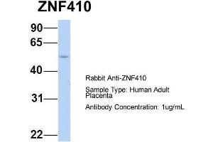 Host: Rabbit Target Name: ZNF410 Sample Type: Human Adult Placenta Antibody Dilution: 1.