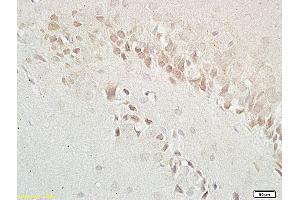 Formalin-fixed and paraffin embedded: rat brain tissue labeled with Anti-GABRB1 Polyclonal Antibody (ABIN669756), Unconjugated at 1:200 followed by conjugation to the secondary antibody and DAB staining (GABBR1 抗体  (AA 651-750))