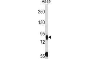 Western Blotting (WB) image for anti-Mucin and Cadherin-Like (CDHR5) antibody (ABIN2997917) (CDHR5 抗体)
