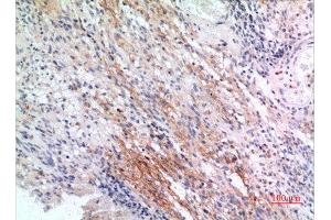 Immunohistochemistry (IHC) analysis of paraffin-embedded Human Brain, antibody was diluted at 1:100. (IFITM1 抗体  (N-Term))