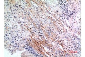 Immunohistochemistry (IHC) analysis of paraffin-embedded Human Brain, antibody was diluted at 1:100. (IFITM1 抗体  (N-Term))