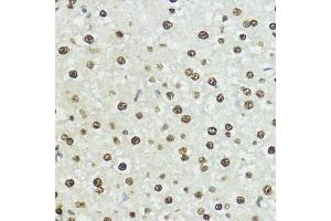 Immunohistochemistry of paraffin-embedded rat liver using Phospho-Histone H3-S10/T11 antibody (ABIN7267688) at dilution of 1:100 (40x lens).