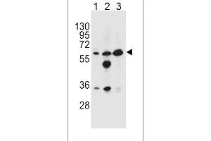 GATM Antibody (N-term) (ABIN654401 and ABIN2844143) western blot analysis in HL-60(lane 1),MDA-M(lane 2),K562(lane 3) cell line lysates (35 μg/lane). (GATM 抗体  (N-Term))