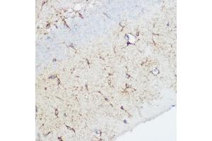 Immunohistochemistry (IHC) image for anti-Calpain 1, Large Subunit (CAPNL1) (AA 20-330) antibody (ABIN3021623)