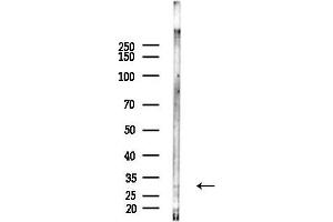 anti-Fibroblast Growth Factor 23 (FGF23) (pSer212) antibody