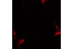 ABIN6267637 staining HepG2 by IF/ICC. (BIK 抗体  (pThr33))
