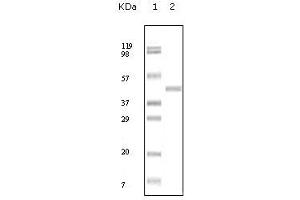 Western Blot showing ABL2 antibody used against truncated ABL2 recombinant protein. (ABL2 抗体)