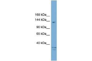 WB Suggested Anti-ARID5B  Antibody Titration: 0. (ARID5B 抗体  (C-Term))
