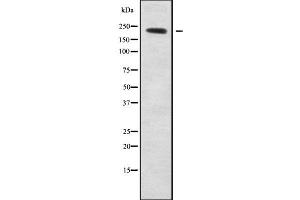 Western blot analysis NAV1 using COS7 whole cell lysates (NAV1 抗体)