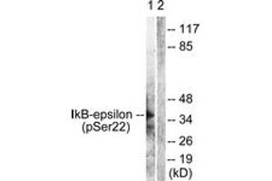 Western blot analysis of extracts from Jurkat cells treated with TNF-a 20ng/ml 30', using IkappaB-epsilon (Phospho-Ser22) Antibody. (IkappaB-epsilon 抗体  (pSer22))