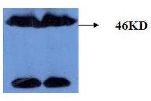 Western Blotting (WB) image for anti-Microtubule-Associated Protein tau (MAPT) (AA 177-187), (pThr181) antibody (ABIN1108153) (MAPT 抗体  (pThr181))