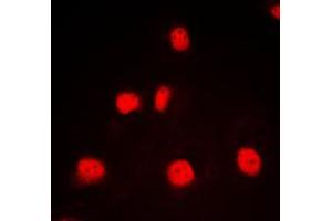 Immunofluorescent analysis of GATA1 staining in K562 cells. (GATA1 抗体  (Center))