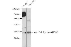 Western blot analysis of extracts of various cell lines, using Mast Cell Tryptase (Mast Cell Tryptase (TPSB2)) antibody (ABIN7271018) at 1:1000 dilution. (TPSB2 抗体  (AA 1-275))