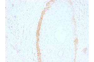 Immunohistochemical staining (Formalin-fixed paraffin-embedded sections) of human skin with KRT15 monoclonal antibody, clone SPM190 . (KRT15 抗体  (C-Term))
