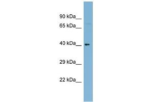 WB Suggested Anti-C1orf92 Antibody Titration: 0. (C1orf92 抗体  (Middle Region))
