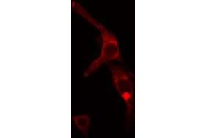 ABIN6272441 staining MCF7 cells by IF/ICC.