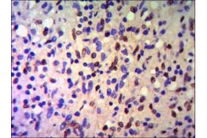 IHC of paraffin-embedded human Spleen using anti-K / TIF1 beta diluted 1/500-1/1000.