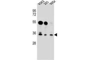Western blot analysis of GLIPR1L2 Antibody (N-term) in K562,293,WiDr cell line lysates (35ug/lane). (GLIPR1L2 抗体  (N-Term))