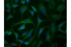 Image no. 4 for anti-Insulin-Like Growth Factor 2 mRNA Binding Protein 2 (IGF2BP2) antibody (ABIN1498825)