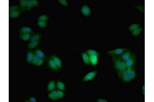 Immunofluorescent analysis of HepG2 cells using ABIN7175485 at dilution of 1:100 and Alexa Fluor 488-congugated AffiniPure Goat Anti-Rabbit IgG(H+L) (VAMP7 抗体  (AA 2-186))