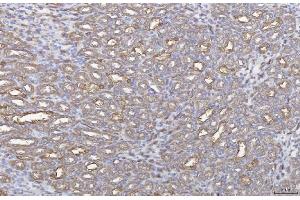 IHC analysis of ANXA4 using anti-ANXA4 antibody (ABIN5518805).