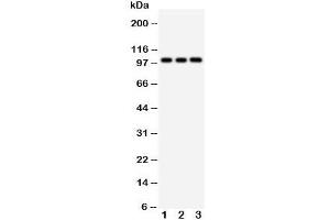 Western blot testing of DDR1 antibody and Lane 1:  A431;  2: A549;  3: HeLa cell lysate. (DDR1 抗体  (C-Term))