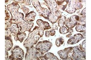 Immunohistochemistry (IHC) image for anti-Chemokine (C-X-C Motif) Receptor 2 (CXCR2) (AA 1-355) antibody (ABIN1889549) (CXCR2 抗体  (AA 1-355))