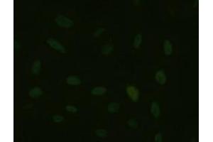 Immunofluorescent staining of HeLa cells using anti-HNF6 mouse monoclonal antibody (ABIN2452681). (ONECUT1 抗体  (AA 85-198))
