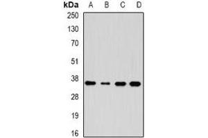 Western blot analysis of AKR7A3 expression in HepG2 (A), HT29 (B), mouse kidney (C), mouse liver (D) whole cell lysates. (AKR7A3 抗体)
