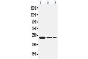 Lane 3: Recombinant Human TRAF1 Protein 1.