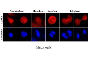 ICC/IF analysis of human HeLa cells stained with Hoechst 3342 (Blue) for chromatin staining and monoclonal anti-human Aurora kinase B antibody (1:2000) with Texas Red (Red). (Aurora Kinase B 抗体  (AA 1-344))