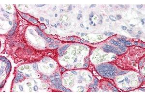 Detection of CCK in Human Placenta Tissue using Polyclonal Antibody to Cholecystokinin (CCK) (Cholecystokinin 抗体  (AA 1-115))