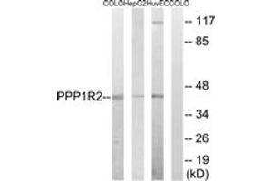 Western blot analysis of extracts from HuvEc/HepG2/COLO cells, using PPP1R2 (Ab-44) Antibody. (PPP1R2 抗体  (AA 10-59))