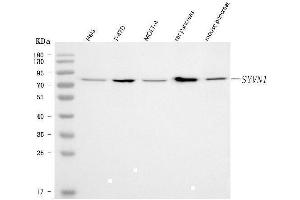 Western blot analysis of HRD1/SYVN1 using anti-HRD1/SYVN1 antibody (ABIN7602291).