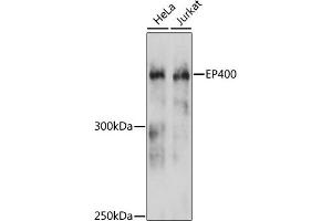 Western blot analysis of extracts of various cell lines, using EP400 antibody (ABIN6127822, ABIN6140195, ABIN6140196 and ABIN6215738) at 1:3000 dilution. (EP400 抗体  (AA 90-330))